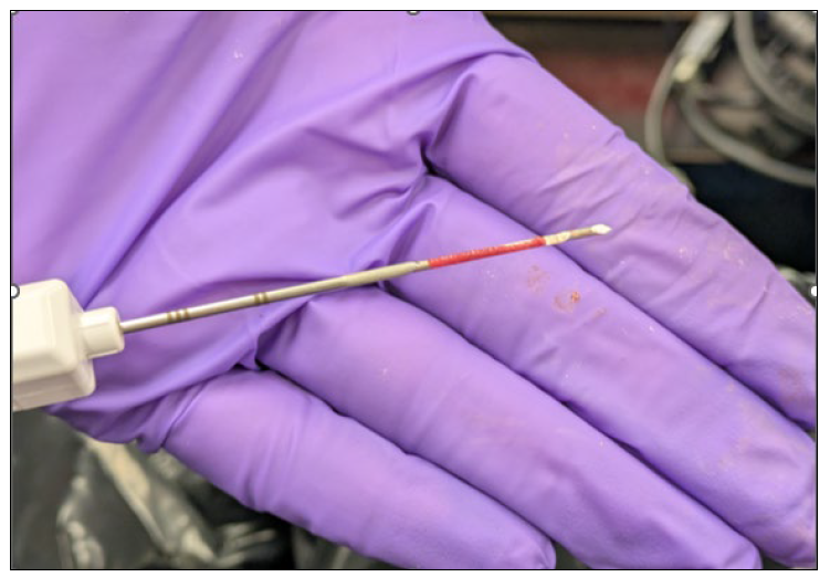 Figure 1. A freshly collected 16-gauge Tru-Cut biopsy sample showing a small core of liver tissue