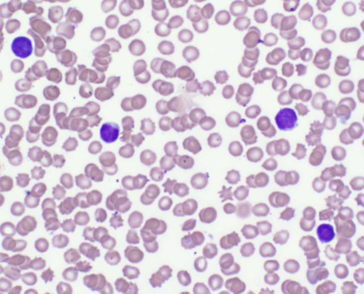 Air-dried, well-stained blood smear.