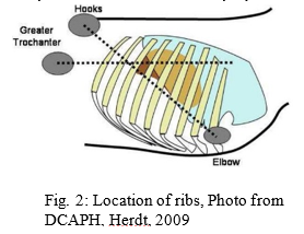 Diagram of ribs and locating biopsy site