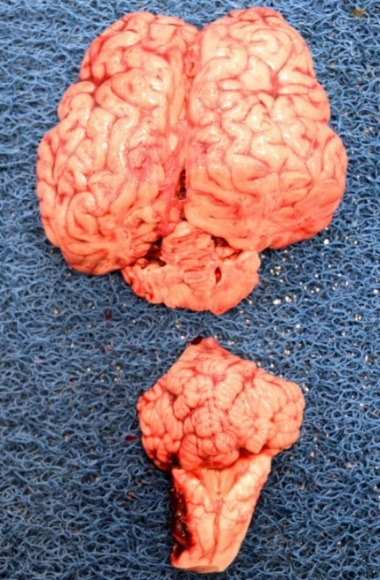 Image of removed brain