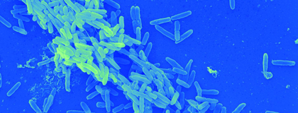 False coloured Pseudomonas aeruginosa