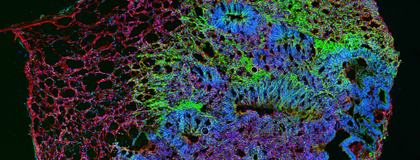 microscopic image of a 3D organoid