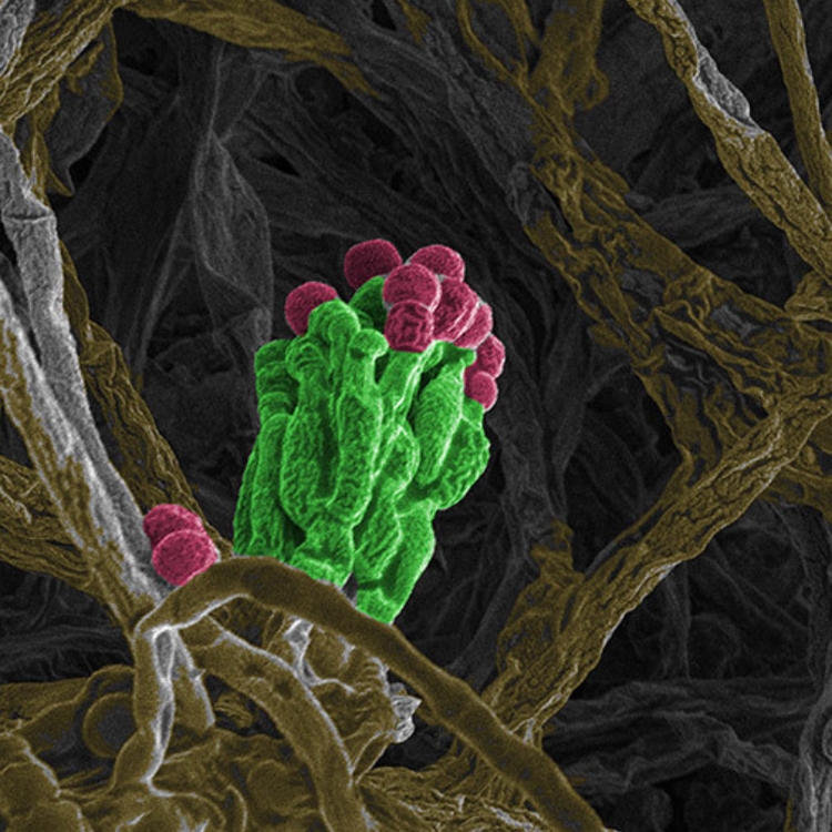 A microscopy image of mold in cheese