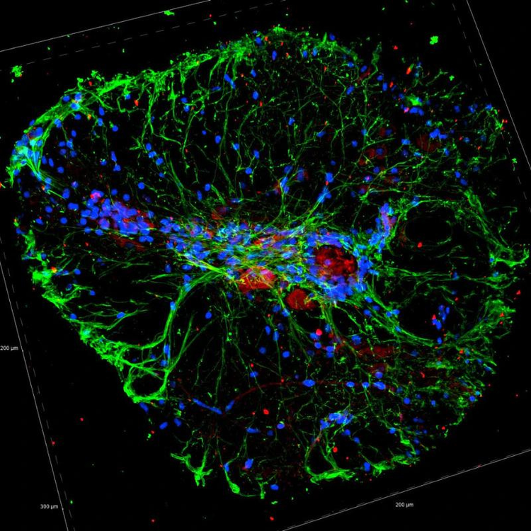 Brain image with green and blue lights, representing neural activity in a digital format.