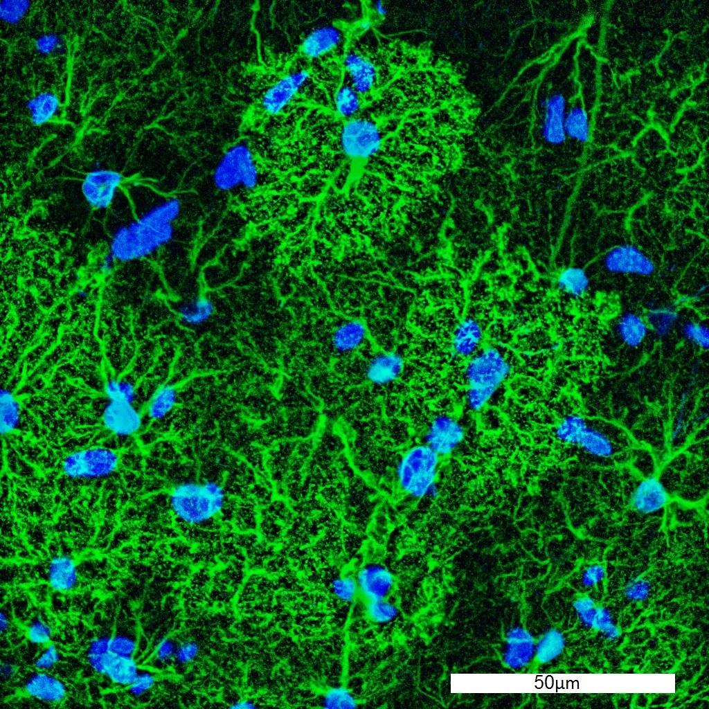 Graphic: Microscopic image of an astrocyte. It depicts hippocampal astrocytes expressing green fluorescent protein (green), and stained with DAPI (blue)   (DAPI stands for 4′,6-diamidino-2-phenylindole) 