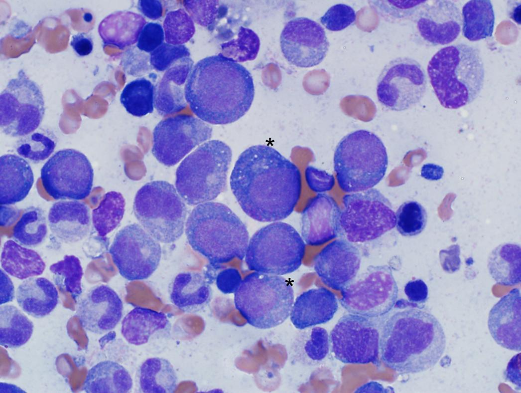 A microscopic image of a bone marrow sample from a dog with AML. The large blue cells (*) are neoplastic blast cells.