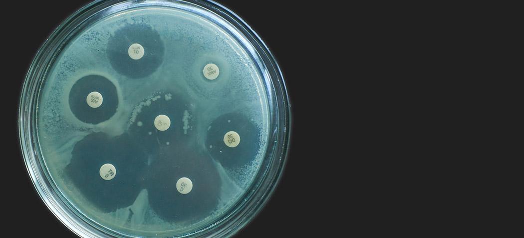 Antimicrobial susceptibility test (iStock credit Nicolae Malancea)