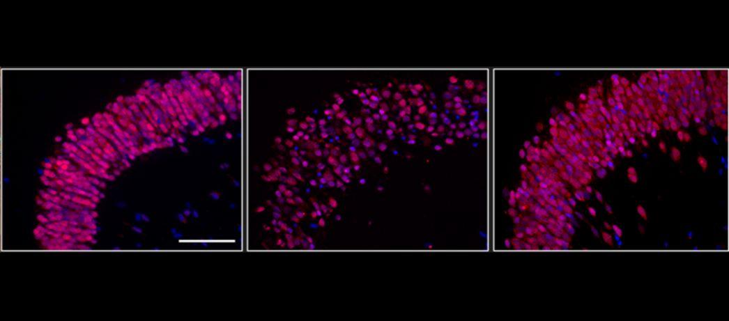 The image shows neuron regeneration in a leopard gecko before injury, 4 days after injury, and 30 days after injury