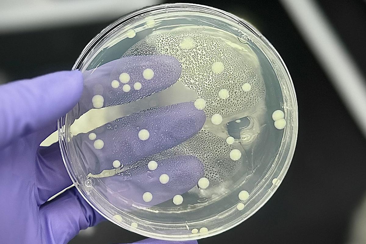 Bacteria inside a petri dish