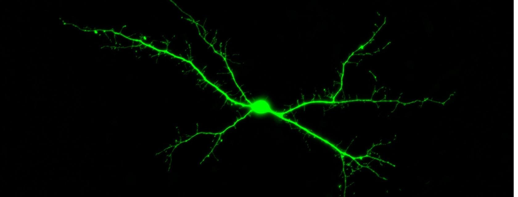 microscopic image of a neuron