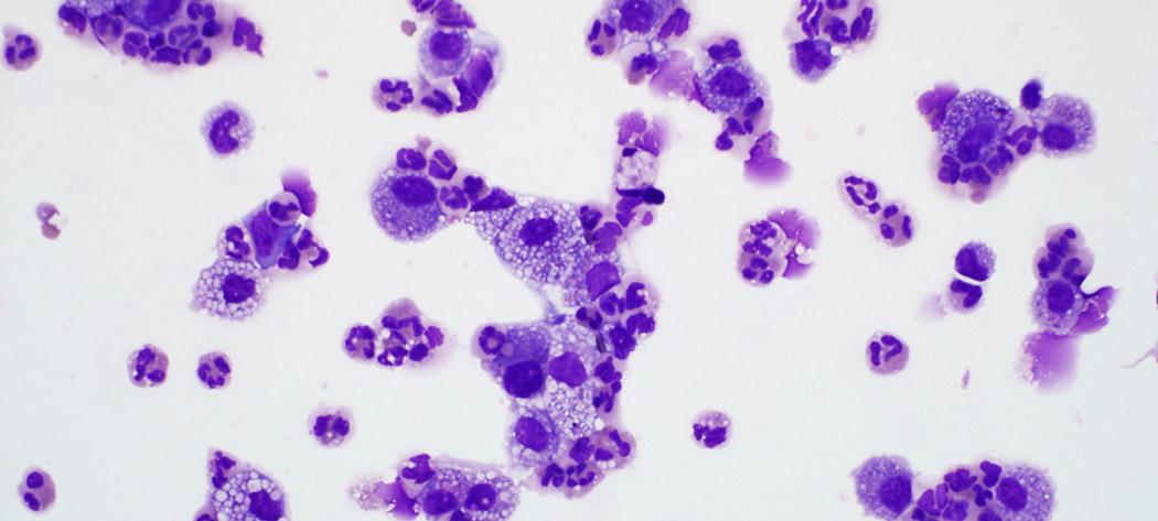 Microscopic image of neutrophils