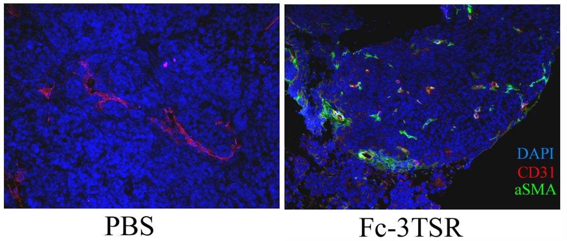 Fc3TSR reduces the presence of large, dysmorphic tumor vessels and increases the proportion of small, luminal, functional vessels covered by smooth muscle cells (green).