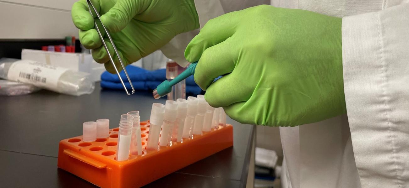 A person wearing a white lab coat and latex gloves placing samples into sample collection tubes