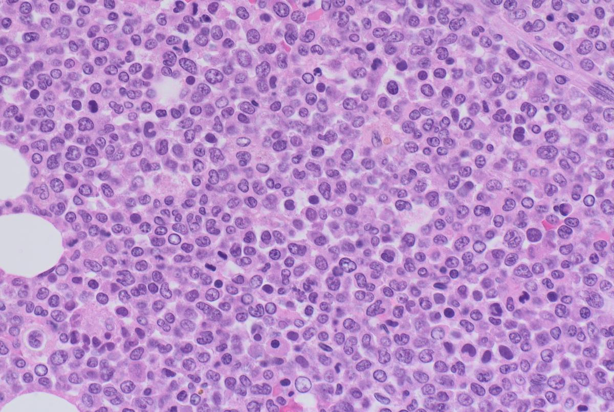 Bone marrow tissue under a microscope