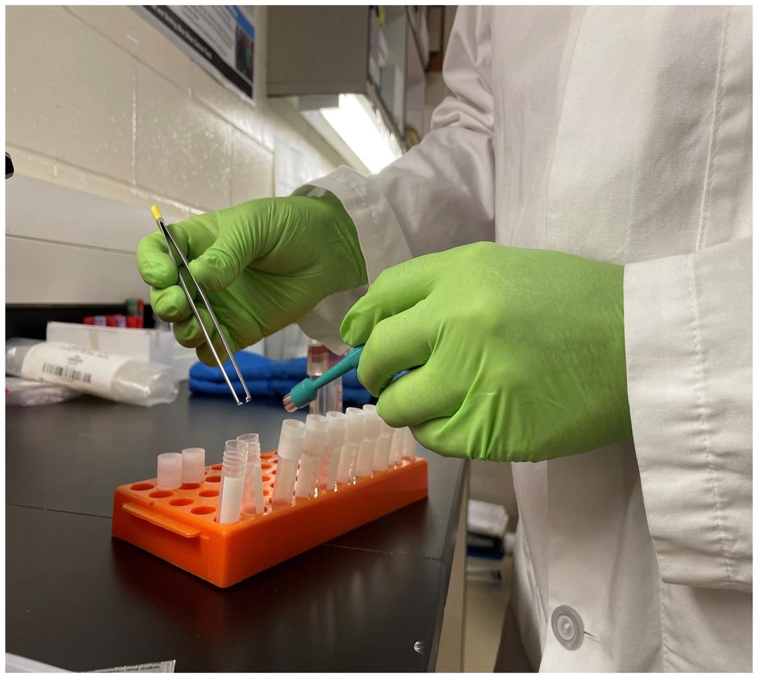A person wearing latex gloves preparing samples in sample collection tubes
