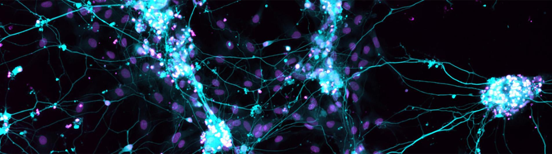 Microscopic image of glowing neural networks with a dark background