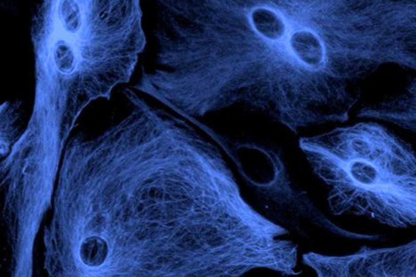 Microscopic image of astrocytes