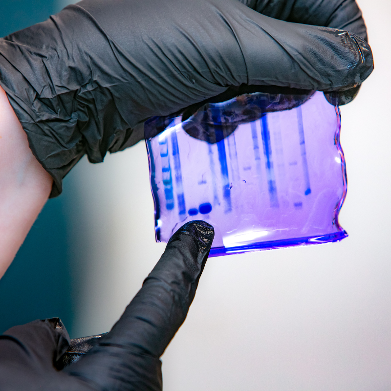 Western blot gel