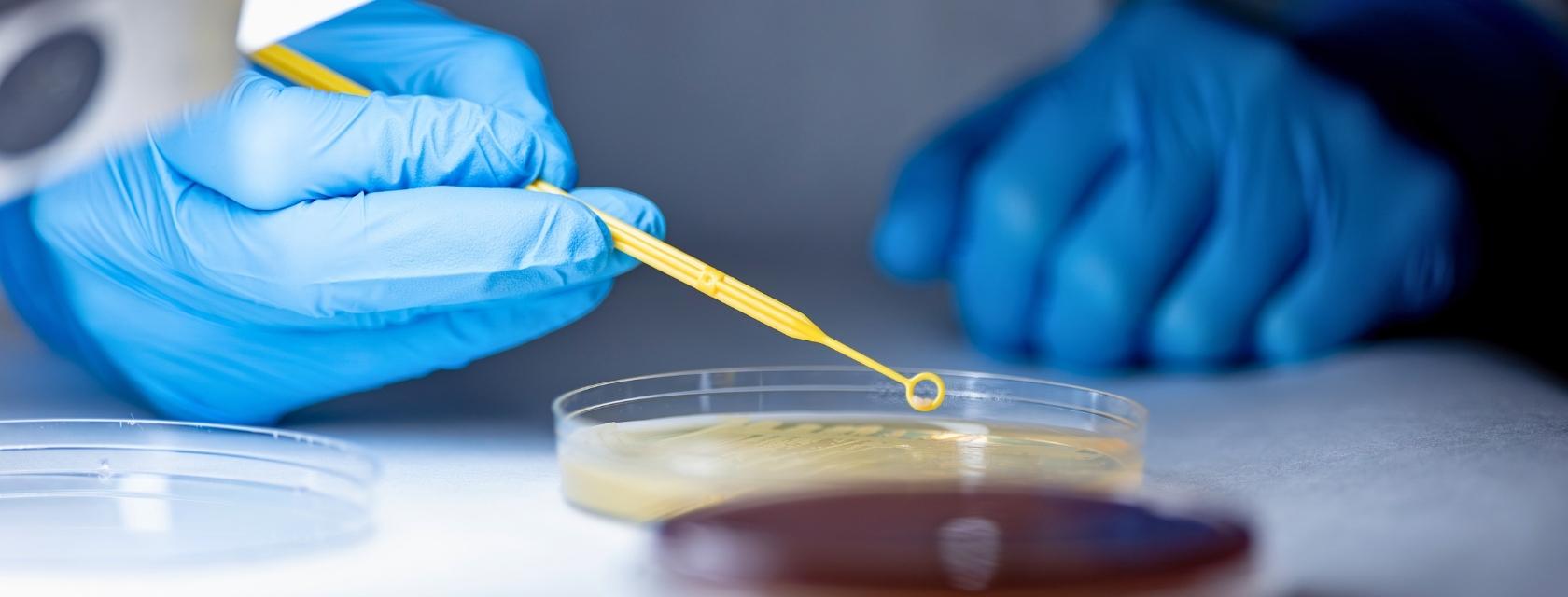 petri dish
