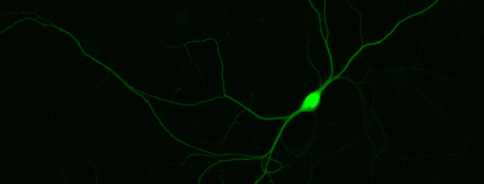 neuron against a black background