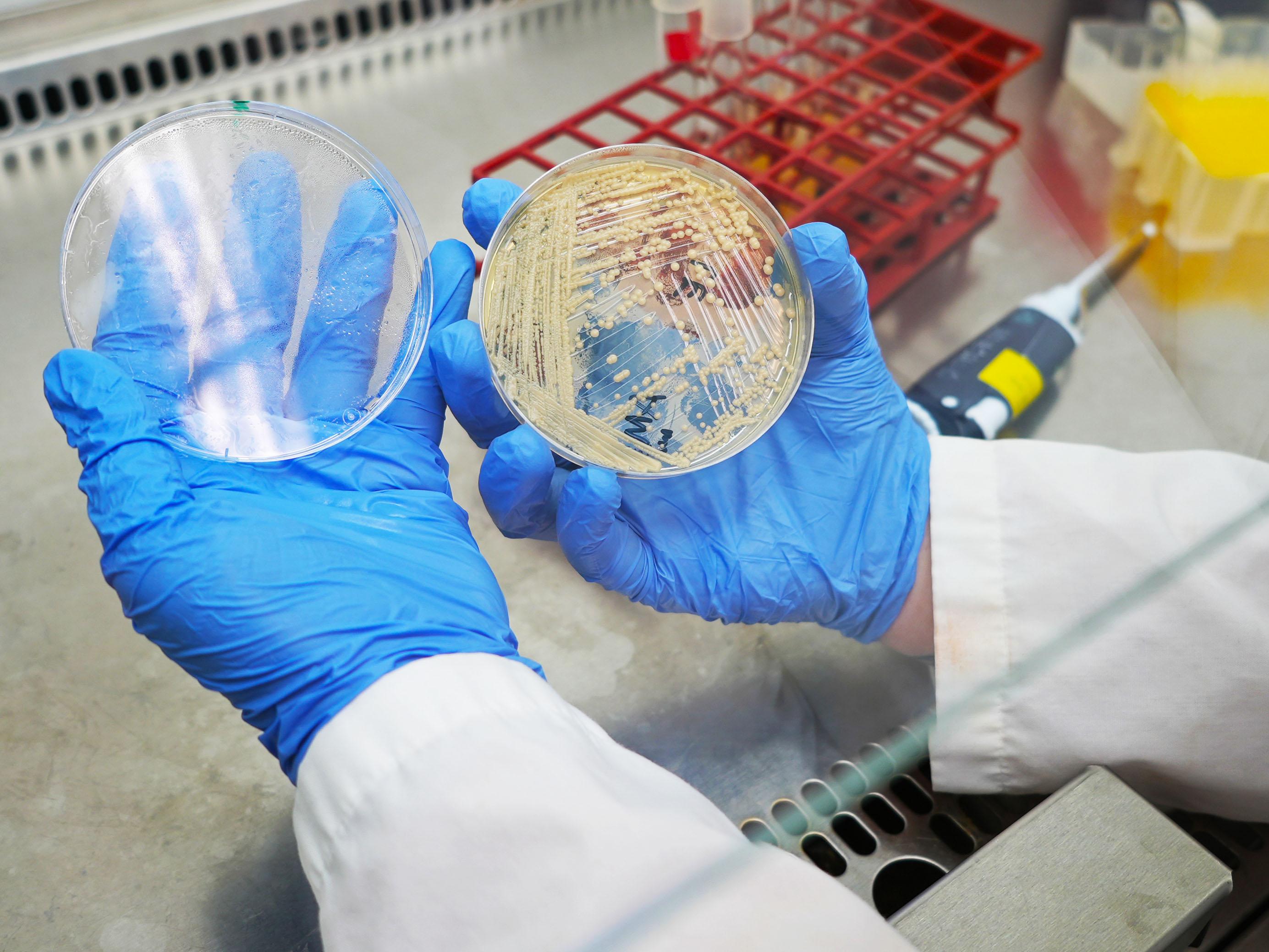 petri dishes in a fume hood streaked with a fungus