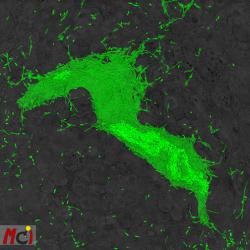 3D reconstruction of Pseudomonas aeruginosa biofilm on epithelial cells