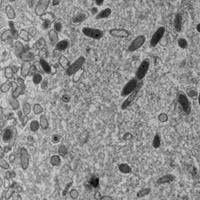 Section through a mixed biofilm