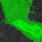 3D reconstruction of Pseudomonas aeruginosa biofilm on epithelial cells