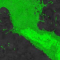 3D reconstruction of Pseudomonas aeruginosa biofilm on epithelial cells