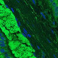 Longitudinal section of immunolabeled rumen epithelium