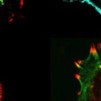 Immunolabeled human tumor cells