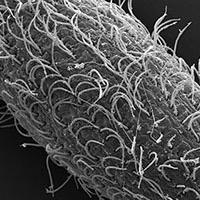 Tetrahymena mobilis SEM