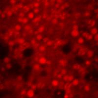 Confocal image of Tetrahymena, mitochondria stained in red