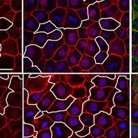 Immunohistochemistry on Zebrafish embryos