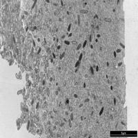 Section through a mixed biofilm
