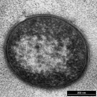 Pseudomonas aeruginosa, cross section