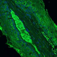 Longitudinal section of immunolabeled rumen epithelium