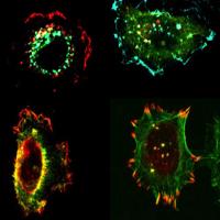 Immunolabeled human tumor cells