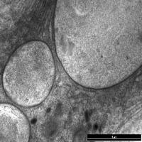 Tetrahymena cross section