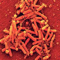 Colourized SEM image of small mixed biofilm assembly including EpL