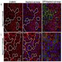 Immunohistochemistry on Zebrafish embryos