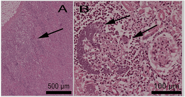 Figure 1A1B Neutrophilic inflammation