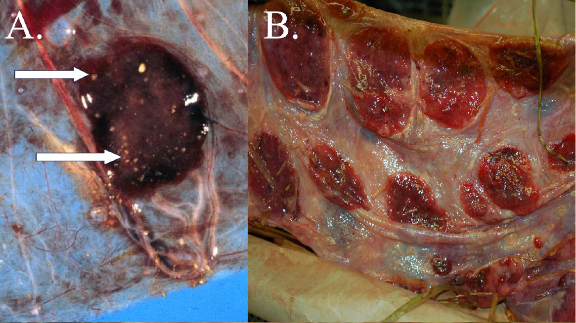  Small ruminant placentitis. A. Toxoplasma placentitis with classical discrete foci of necrosis and mineralization of the cotyledon (arrows). B. Coxiella placentitis with thickened opaque intercotyledonary spaces. C. Chlamydia placentitis with abundant inflammatory exudate and necrosis involving cotyledons and intercotyledonary spaces.