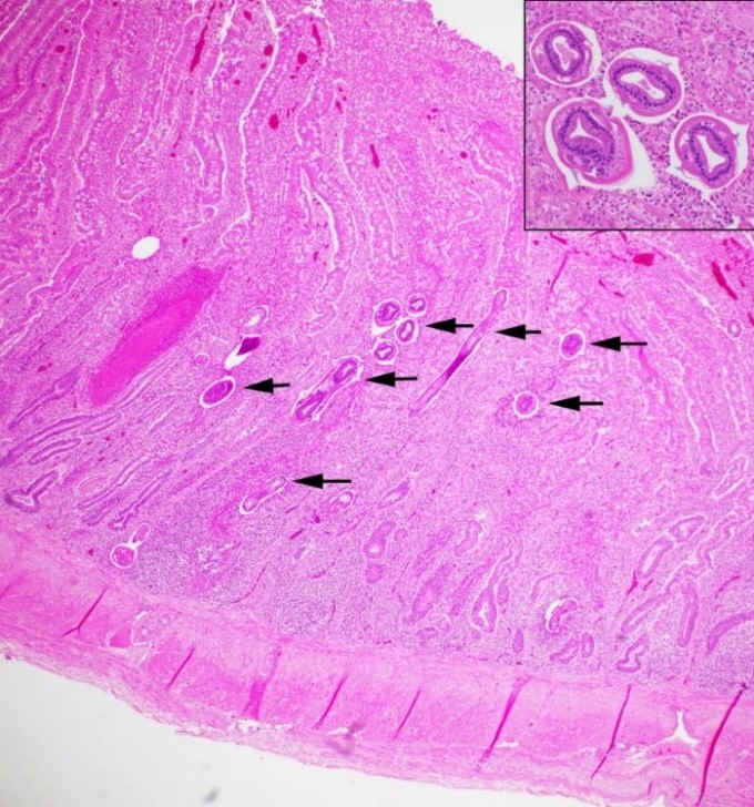  higher magnification of larvae). (H&E)