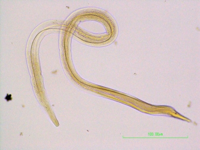 Figure 2.  Ascaridia galli larval stage detected in the mucosal scrapings of the small intestine.