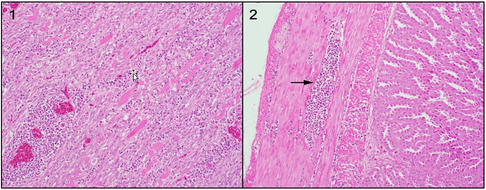 Figure 1.  Skeletal muscle with lymphoplasmacytic inflammation, myofibre necrosis and atrophy.  H&E. Figure 2.  Lymphoplasmacytic infiltration of the muscular wall of the proventriculus (arrow).  This lesion is pathognomonic for avian encephalomyelitis. H&E. 