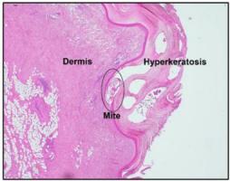 Figure 1. Histology of skin showing hyperkeratosis and burrowed mite (H&E, 4x).