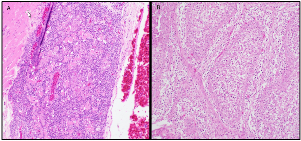 Figure 1.  Histologic lesions caused by immunosuppressive viruses.