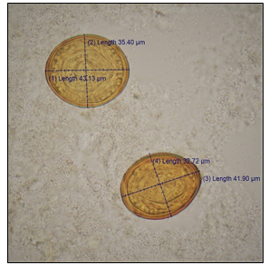 Figure 1. Platynosomum fastosum eggs obtained from centrifugal sedimentation of bile with measurements.