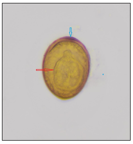 Figure 2.  Fluke eggs showing operculum (blue arrow) and miracidium (red arrow).
